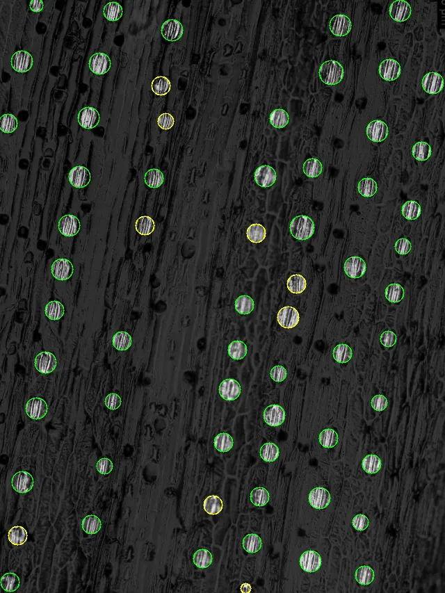 Plant organ counting with computer vision
