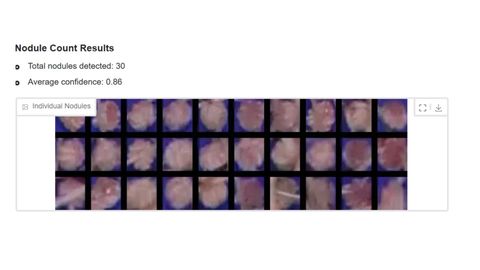 Nodule Count Results panel reading total nodules detected 30, average confidence 0.86, above a grid of thirty individual cropped nodule images.